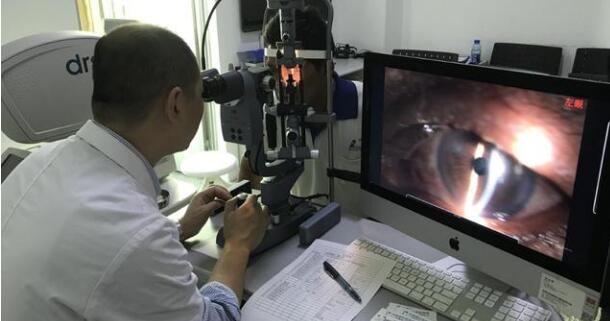 10月29日，一位职业性白内障男子，在厦门眼科中心手术后 复明。值得一提的，不少人对于其从事职业会导致的“职业性白内障”并不在意，但根据厦门眼科中心白内障专科陈伟主任介绍，在接诊中，职业性白内障并不少见，对于这些行业从业人员如何做好眼病防护，也进行了详细的介绍。.jpg