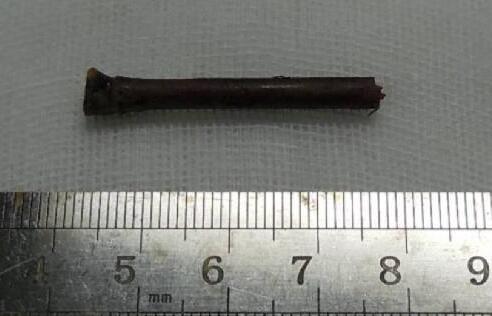 “小小竹棍把我害的好苦啊!幸好，遇到了厦门眼科中心眼整形科的胡继发副主任。医术好、态度好。大医院 医生就是不一样!”——医治眼睛后的老李激动的说道2.jpg