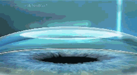 因为从手术原理来说，近视矫治手术是根据你需要 的近视度数，切削掉相应厚度的角膜，术后切削掉的角膜并不会再生长出来，所以，已经 的度数并不会复发1.png