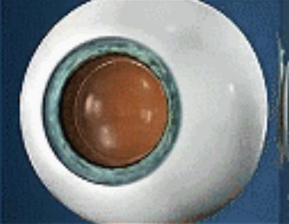 升学、征兵、公务员、就业，对于近视朋友而言，这些总是拦路虎……如今有多种近视 方法，想要摘镜，总有一款适合您.jpg