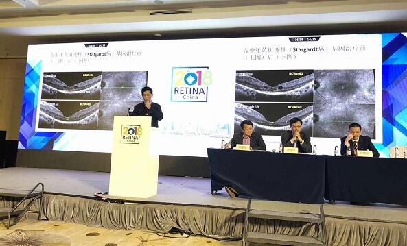 3月28日，为期4天的中国眼底病领域一年一度的学术年会“2018中国眼底病论坛暨环球视网膜研讨会”(RetinaChina 2018)在中国青岛召开。本次论坛由中国环球科技交流中心主办，《中华眼底病杂志》协办，会上翘楚云集，盛况空前，既是眼底病学诊疗领域的高水平年度学术盛会，也是世界眼底专家的一*次交流盛会4.jpg