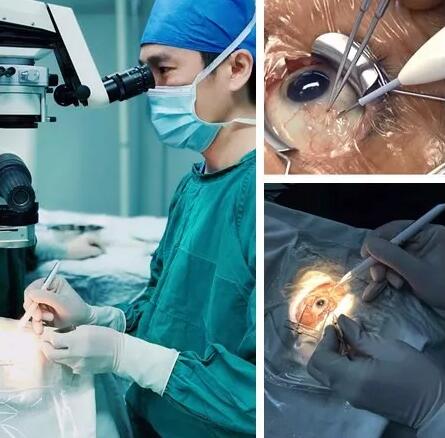 黄斑水肿是造成视网膜静脉阻塞患者低视力的主要原因，而炎症则是引起黄斑水肿的重要病理改变。所以控制炎症就能抑制黄斑水肿， 患者视力2.jpg