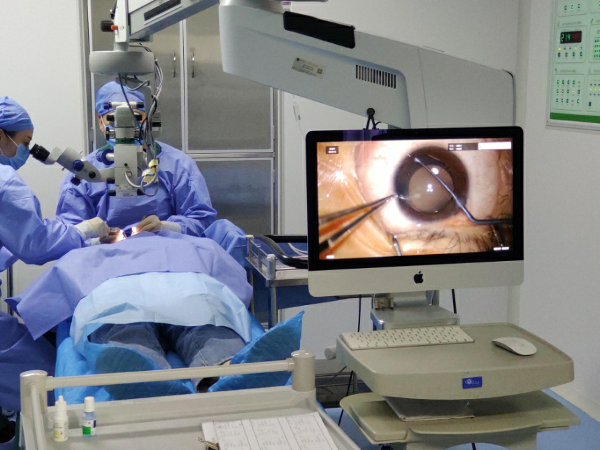 青岛ICL晶体植入术直播 青岛ICL晶体植入术直播