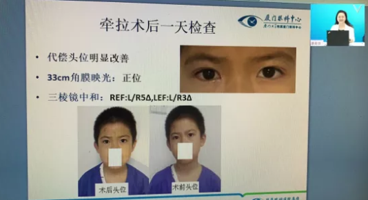 高峰论道·云端荟萃 ▏万人同步在线，30余名大咖云集“第六届易游体育论坛斜视与小儿眼科新技术学习班暨小儿、眼视光分论坛”7.png