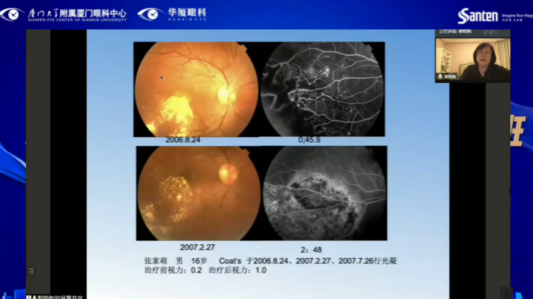 高峰论道·云端荟萃 ▏万人同步在线，30余名大咖云集“第六届易游体育论坛斜视与小儿眼科新技术学习班暨小儿、眼视光分论坛”6.png