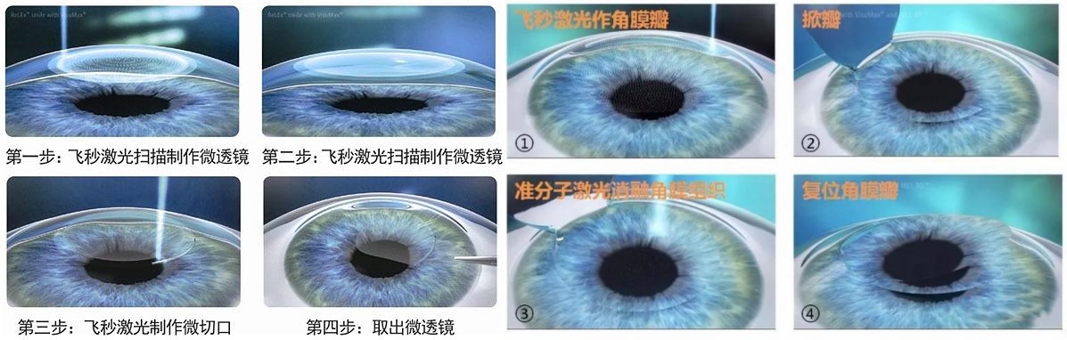 全飞半飞步骤.jpg 全飞半飞步骤.jpg